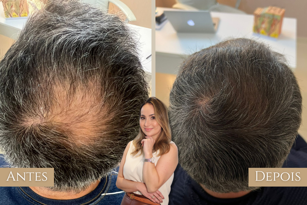 Antes e depois 4