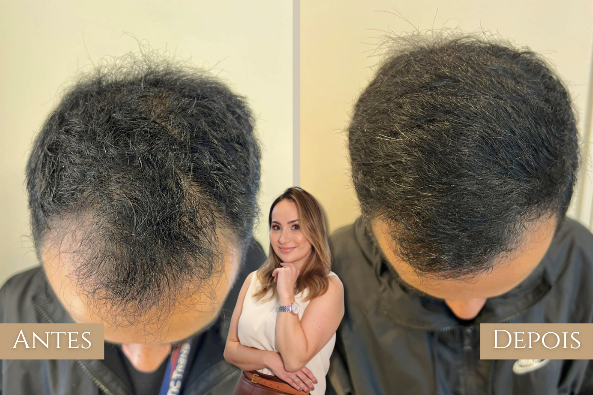 Antes e depois 3