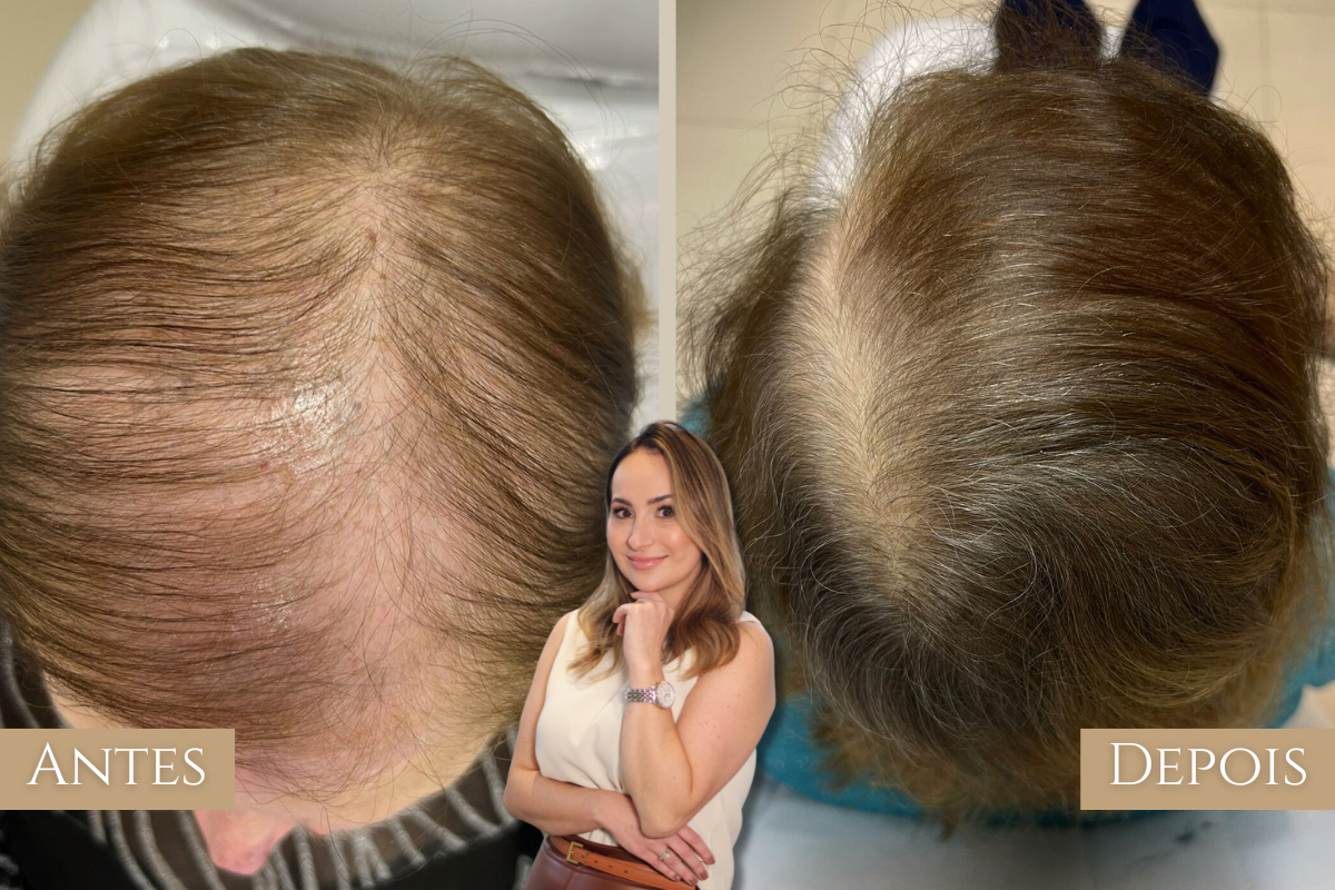 Antes e depois 2
