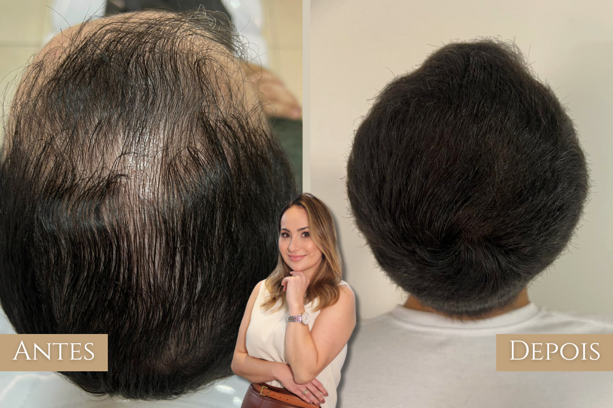 Antes e depois 1