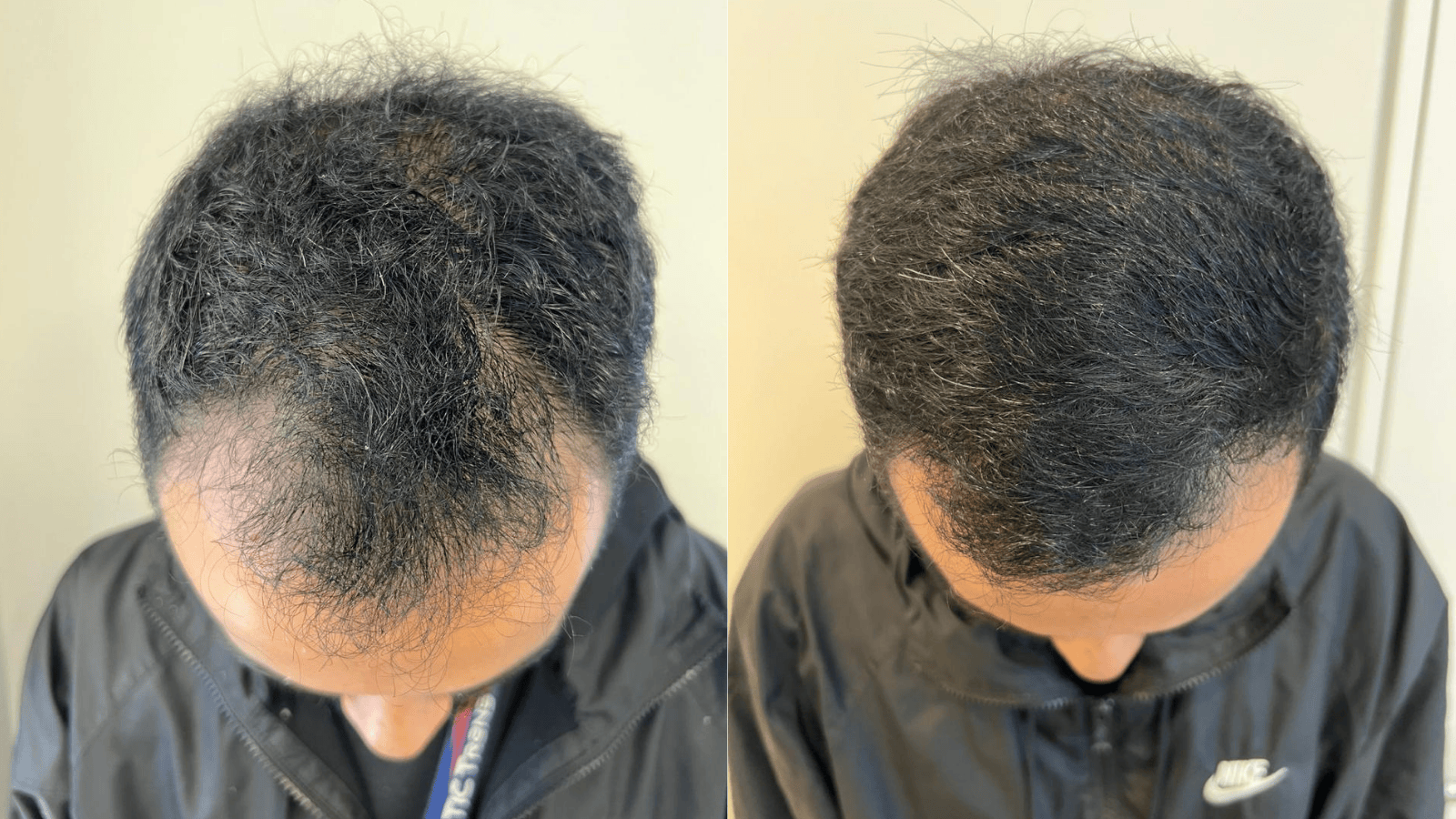 Antes e Depois - Slide 3