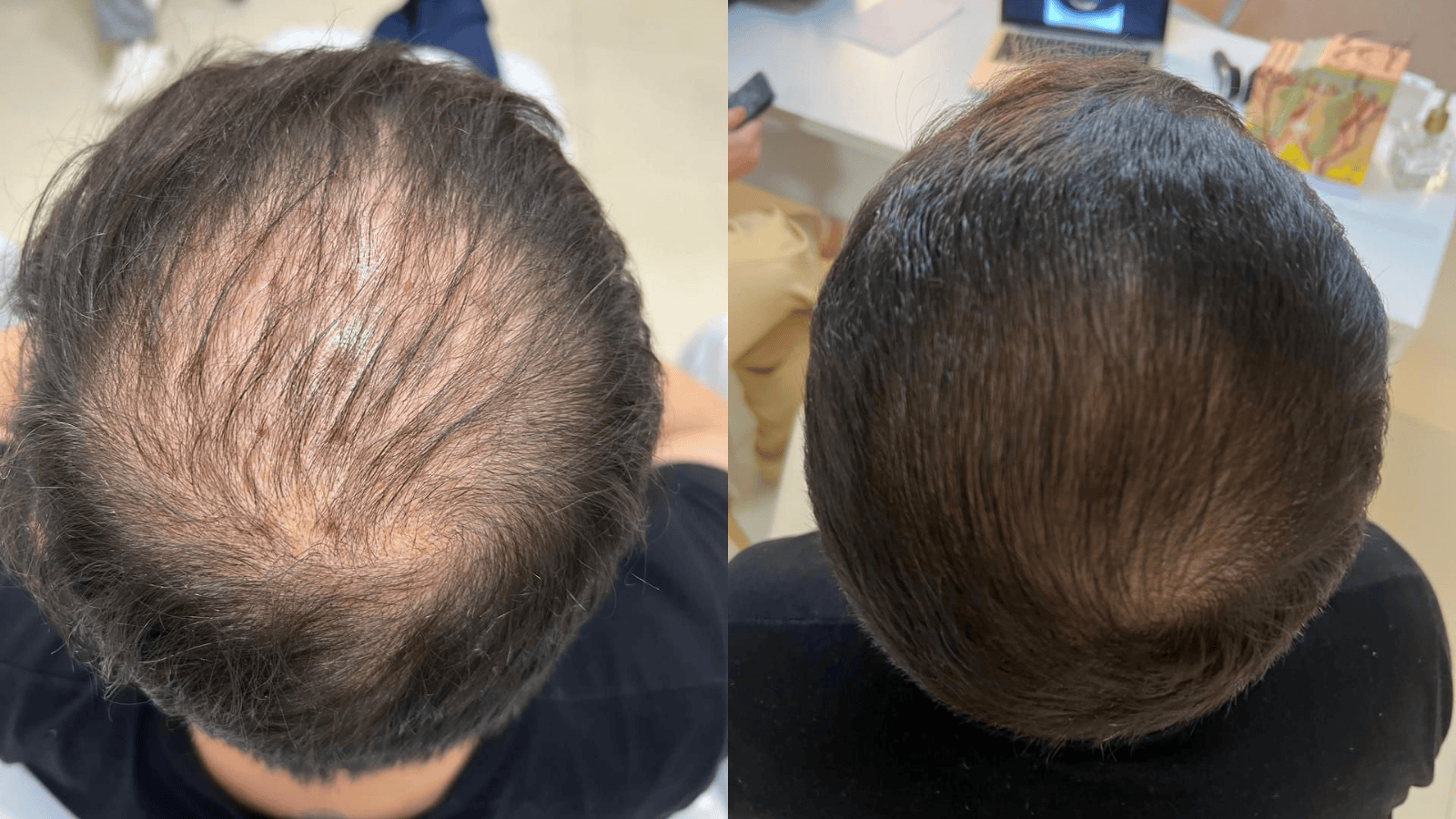 Antes e Depois - Slide 4