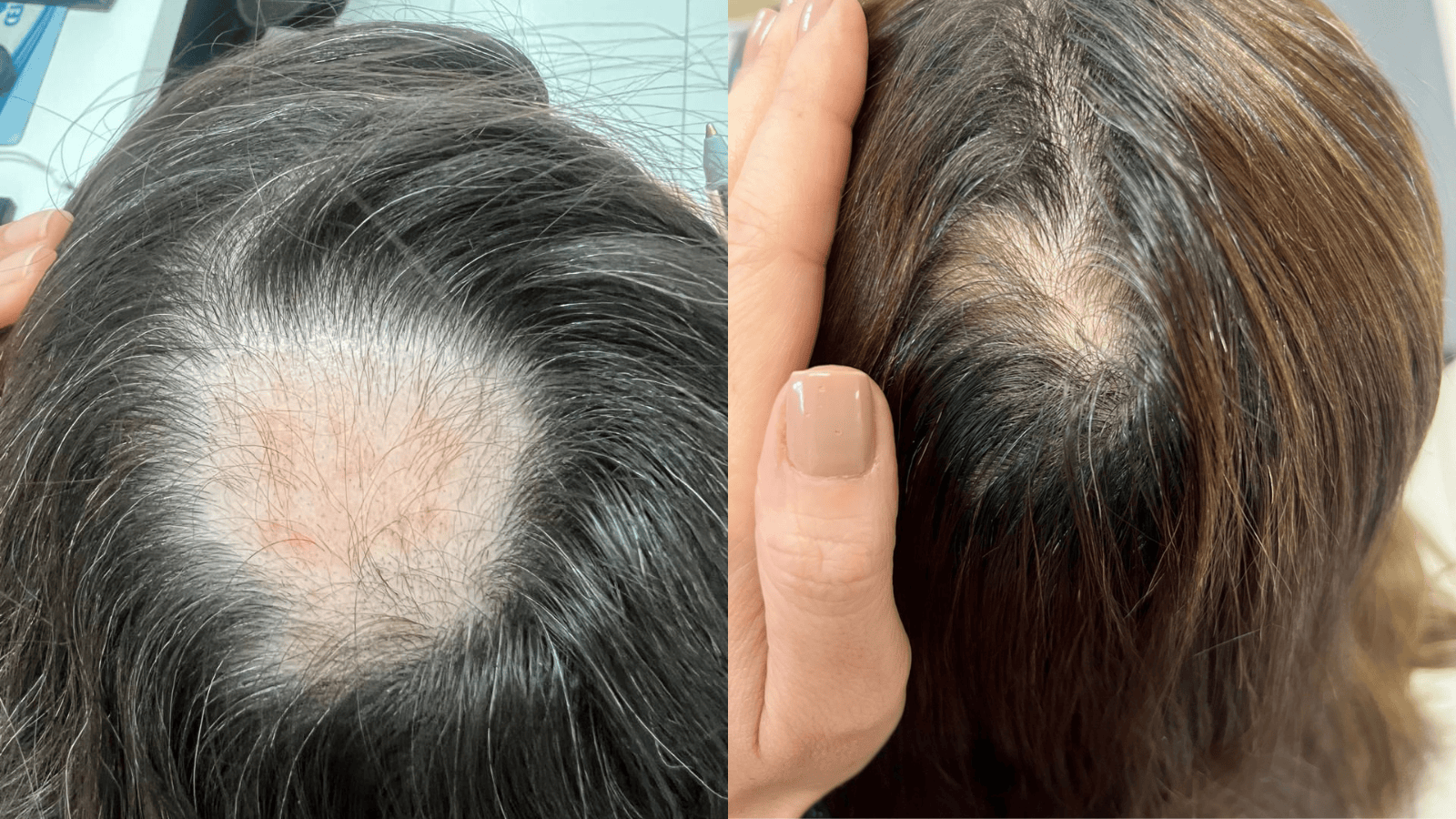 Antes e Depois - Slide 5