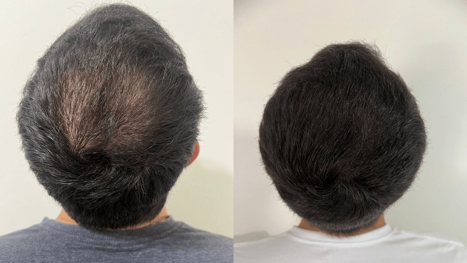 Antes e Depois - Slide 6
