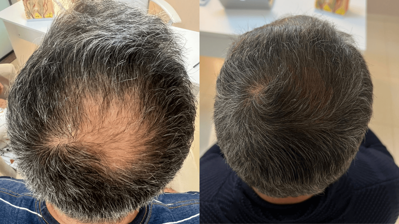 Antes e Depois - Slide 1