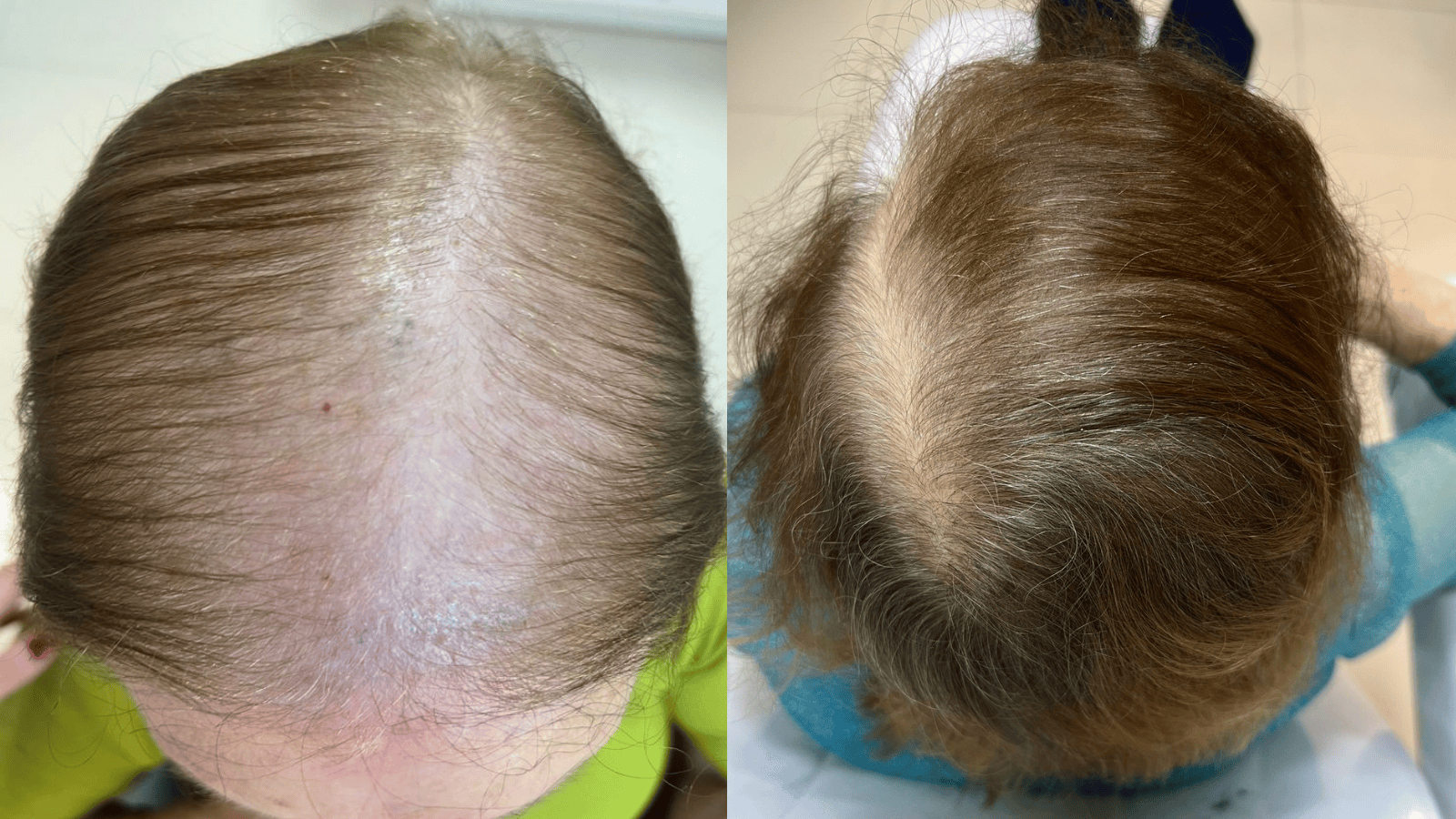 Antes e Depois - Slide 2