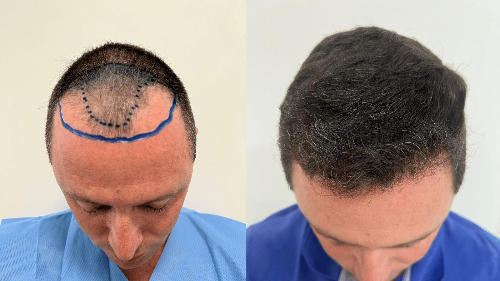 Antes e Depois - Slide 7